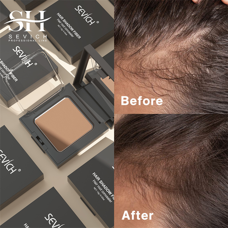 SEVICH 12g Hairline Powder Wit – Rooting Hormone Powder Bewertung und Preis