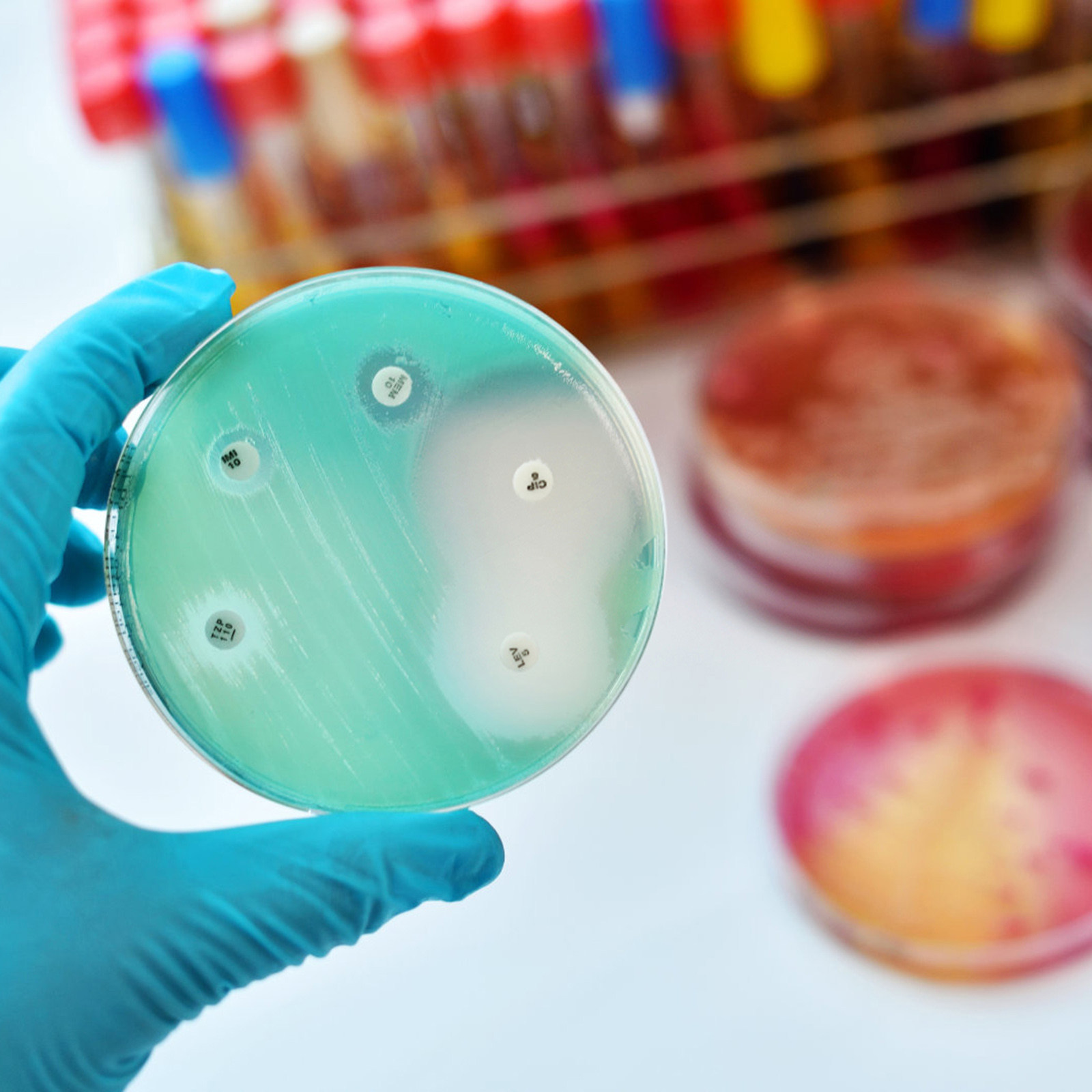 30Pcs Petri Dishes Plastic Cle – Agar Tissue Culture Bewertung und Preis